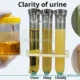Cloudiness in Urine